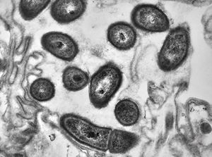 M,39y. | skin - folliculitis M,39y. | skin - folliculitis